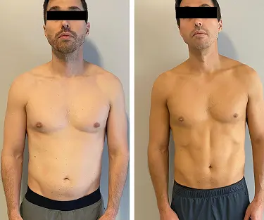 Progress Picture Protocol